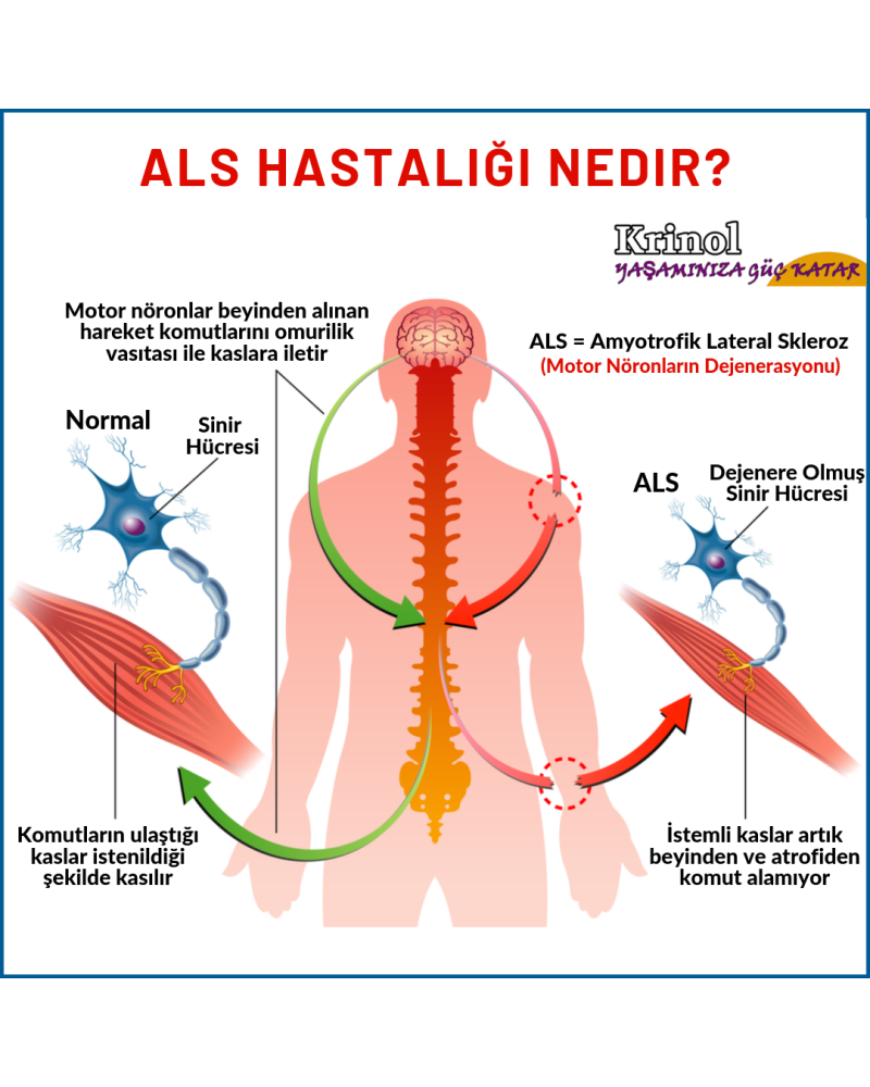 ALS Hastalığı Nedir?